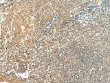 HEBP1 Polyclonal Antibody