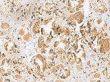 HEBP1 Polyclonal Antibody