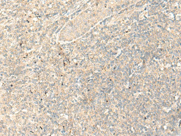 RGR Polyclonal Antibody