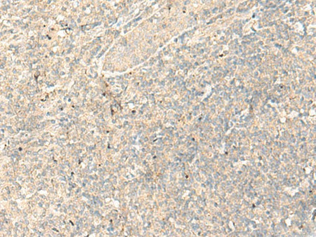 RGR Polyclonal Antibody