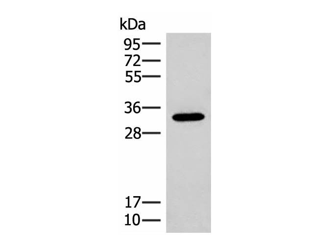 RGR Polyclonal Antibody