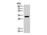 RGR Polyclonal Antibody