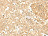 HPCA Polyclonal Antibody