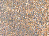 HPCA Polyclonal Antibody