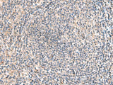HLA-DOB Polyclonal Antibody