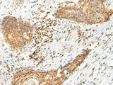 HMBOX1 Polyclonal Antibody