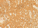 KRT76 Polyclonal Antibody