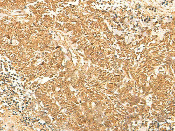 KRT76 Polyclonal Antibody
