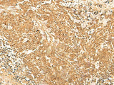 KRT76 Polyclonal Antibody