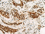 HNRNPA3 Polyclonal Antibody
