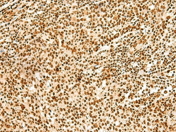 HNRNPA3 Polyclonal Antibody