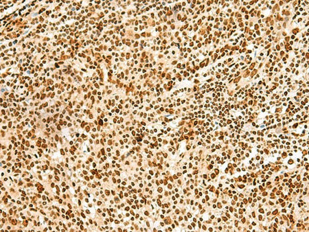 HNRNPA3 Polyclonal Antibody