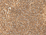 SIX6 Polyclonal Antibody