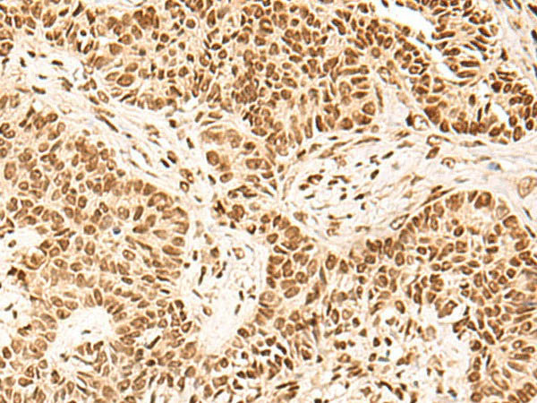 HOXC13 Polyclonal Antibody