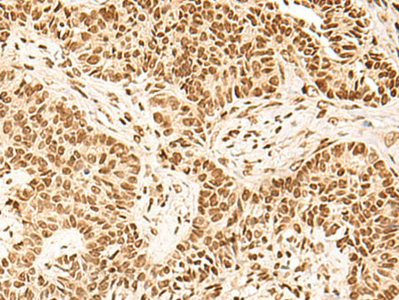 HOXC13 Polyclonal Antibody