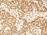 HOXC13 Polyclonal Antibody
