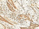 HOXC13 Polyclonal Antibody