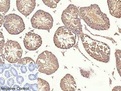 Beta Tubulin Monoclonal Antibody Store at -20°C Host Mouse
