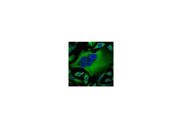Beta Tubulin Monoclonal Antibody Store at -20°C Host Mouse