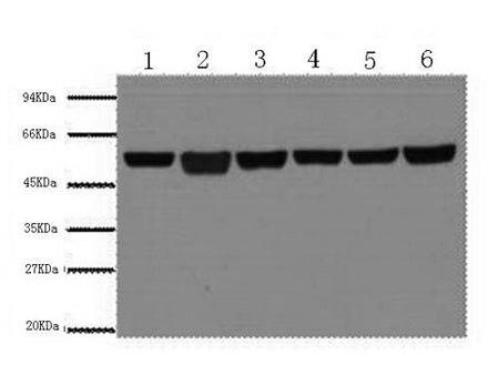 Beta Tubulin Monoclonal Antibody Store at -20°C Host Mouse