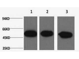Beta Tubulin Monoclonal Antibody Store at -20°C