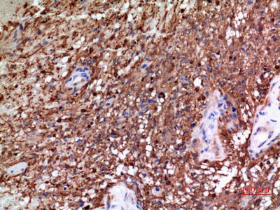 Alpha Tubulin Polyclonal Antibody