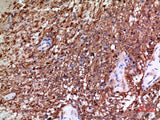 Alpha Tubulin Polyclonal Antibody