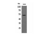 Alpha Tubulin Polyclonal Antibody