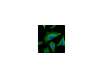 Beta Tubulin Monoclonal Antibody