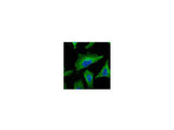 Beta Tubulin Monoclonal Antibody