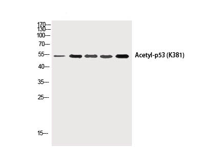 Acetyl-P53 (Lys381) Polyclonal Antibody
