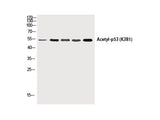 Acetyl-P53 (Lys381) Polyclonal Antibody