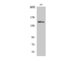 Phospho-MAP3K5 (Ser966) Polyclonal Antibody