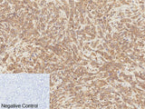 Phospho-Catenin Beta (Ser37) Polyclonal Antibody