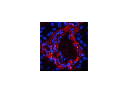 Phospho-Catenin Beta (Ser37) Polyclonal Antibody