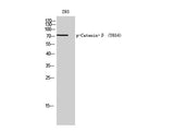 Phospho-Catenin Beta (Tyr654) Polyclonal Antibody