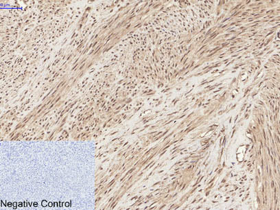Phospho-CHEK2 (Thr68) Polyclonal Antibody