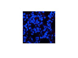 Phospho-CHEK2 (Thr68) Polyclonal Antibody