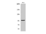 Phospho-CHEK2 (Thr68) Polyclonal Antibody