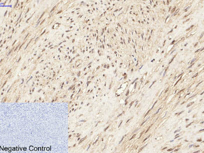 Phospho-ERK 1/2 (Tyr204) Polyclonal Antibody