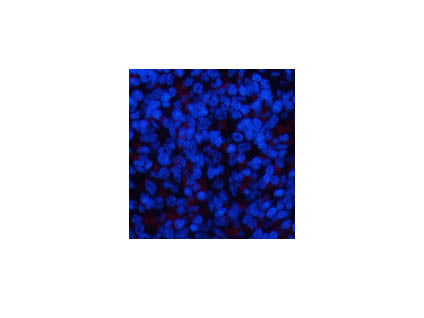 Phospho-ERK 1/2 (Tyr204) Polyclonal Antibody