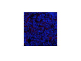 Phospho-IkB Alpha (Ser32/S36) Polyclonal Antibody
