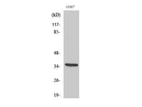 Phospho-IkB Alpha (Ser32/S36) Polyclonal Antibody