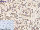 Phospho-JAK1 (Tyr1022) Polyclonal Antibody