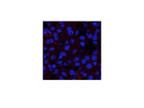 Phospho-JAK1 (Tyr1022) Polyclonal Antibody