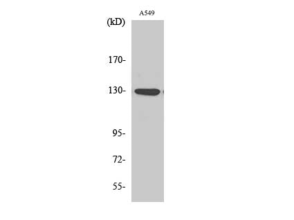 Phospho-JAK1 (Tyr1022) Polyclonal Antibody