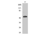 Phospho-P53 (Ser46) Polyclonal Antibody