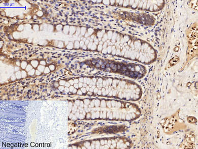 Phospho-PI 3 Kinase p85 Alpha /Gamma (Tyr467/199) Polyclonal Antibody