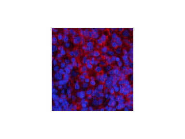 Phospho-PI 3 Kinase p85 Alpha /Gamma (Tyr467/199) Polyclonal Antibody