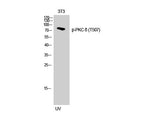 Phospho-PKC Delta (Thr507) Polyclonal Antibody